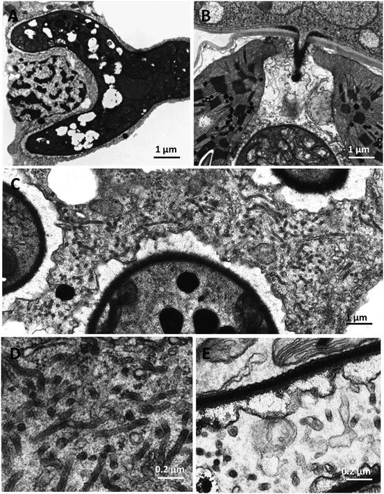 Wheat Puccinia Striiformis Interactions Springerlink - 