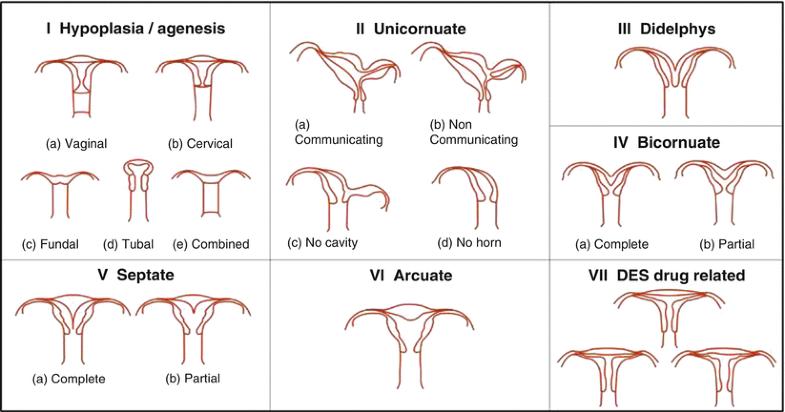 Ultrasound Evaluation of Congenital Uterine Anomalies ...