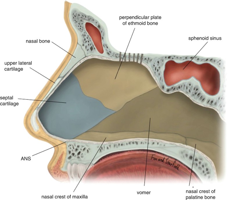 deviated nose correction and functional rhinoplasty springerlink