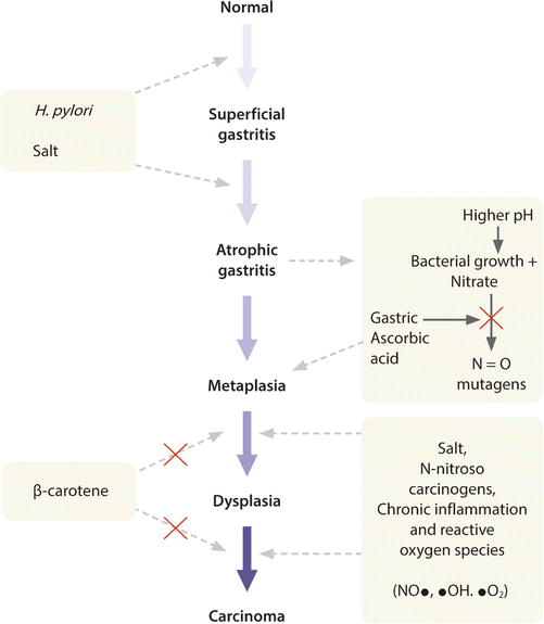 Atrophic Gastritis and Intestinal Metaplasia | SpringerLink