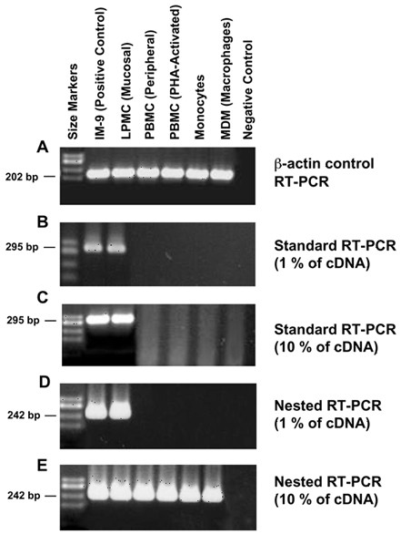 Rtpcr : RTPCR_360百科 / February 12, 2010 7:04 am.