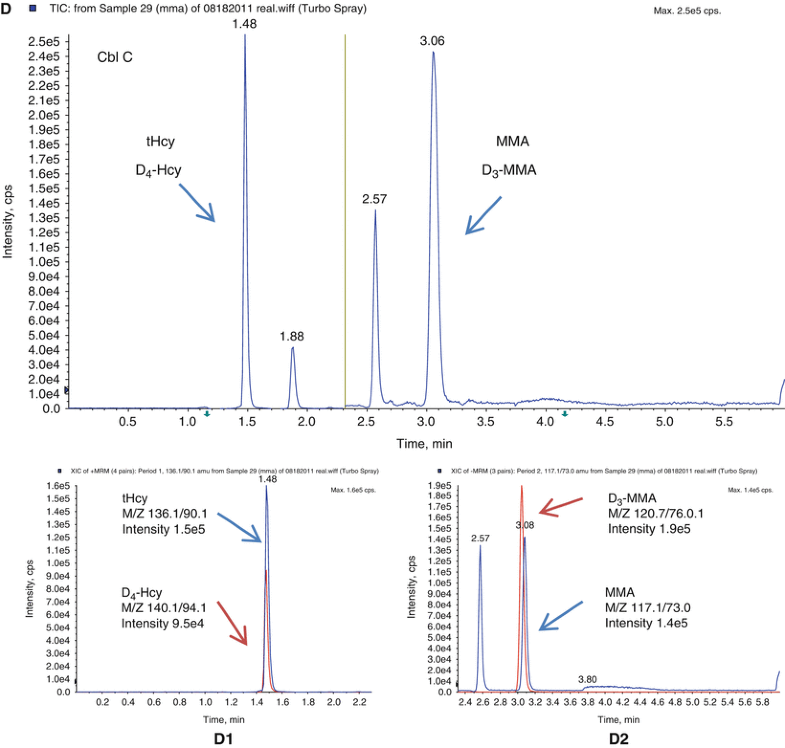 Simple, Fast, and Simultaneous Detection of Plasma Total Homocysteine