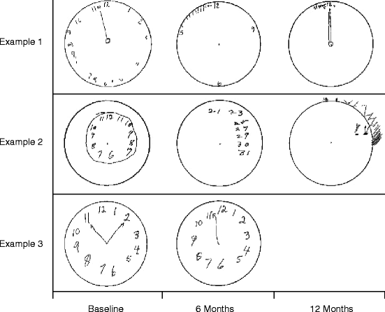 Clock Drawing Test | SpringerLink