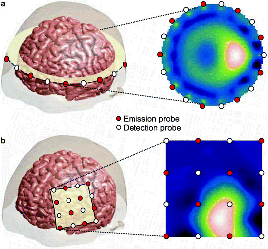 Photon Migration in NIRS Brain Imaging SpringerLink