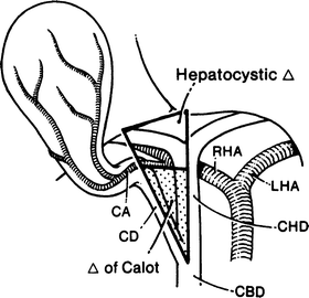 Extrahepatic Biliary Tract | SpringerLink