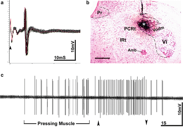 Techniques for Extracellular Recordings | SpringerLink
