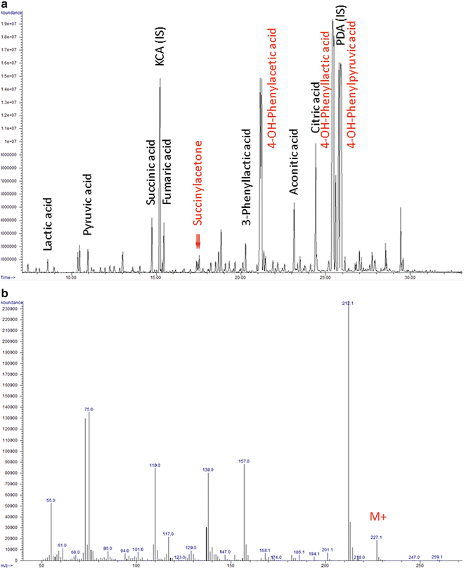 Urinary Succinylacetone Analysis by Gas Chromatography-Mass ...