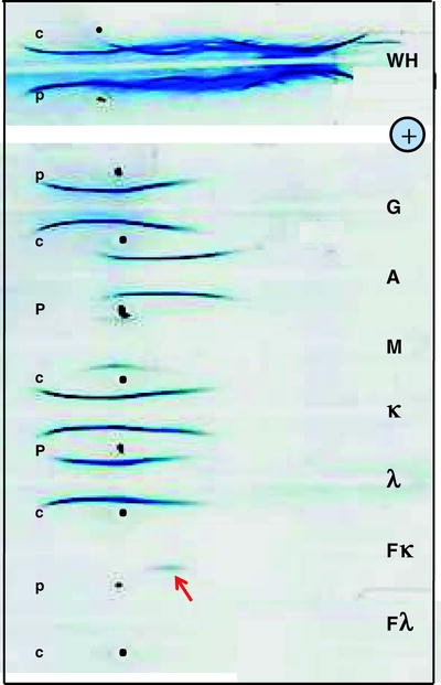 Immunoelectrophoresis: A Method with Many Faces  SpringerLink