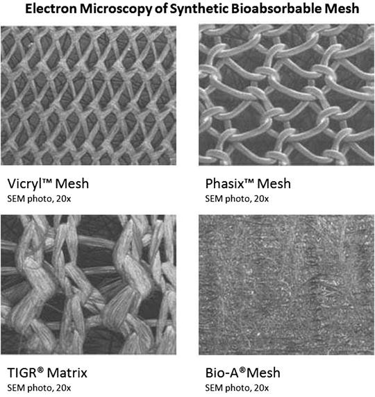 Biodegradable Meshes in Abdominal Wall Surgery SpringerLink