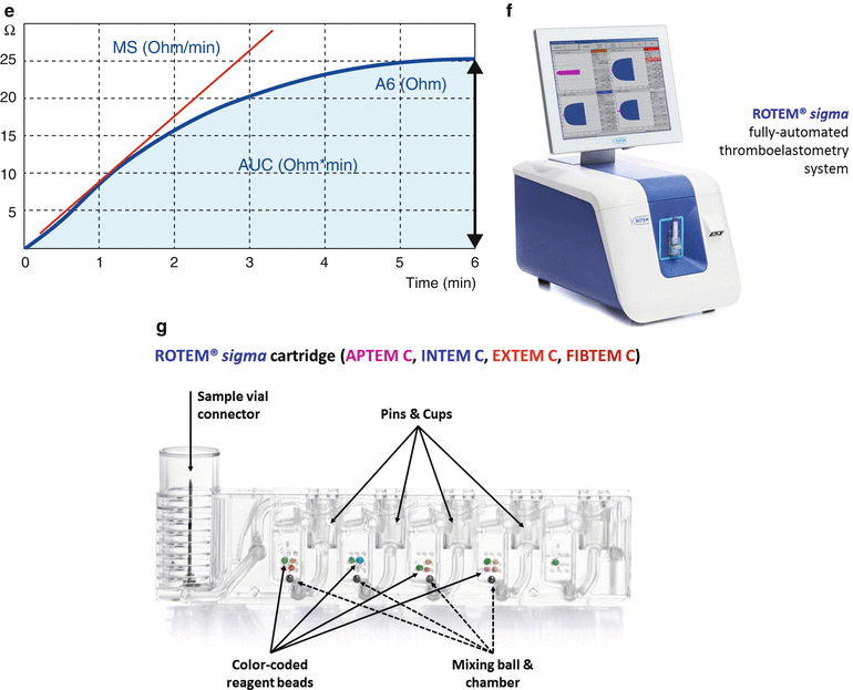 Whole Blood Assay Thromboelastometry SpringerLink
