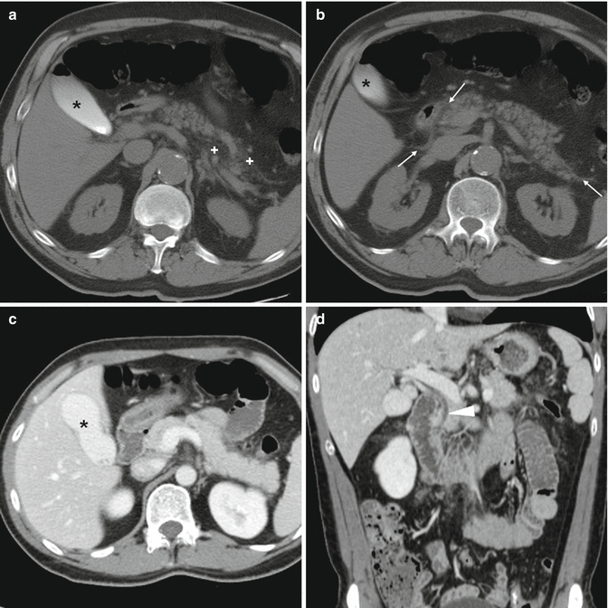 Black Stool After Ercp - Stools Item Black Stool After Ercp - Stools Item
