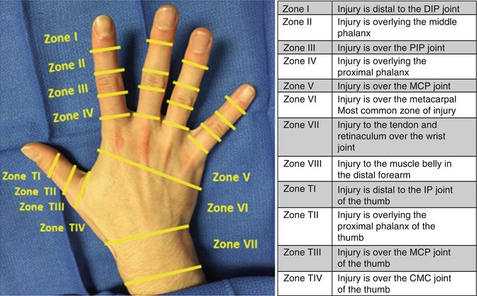 Extensor Tendons Hand Anatomy