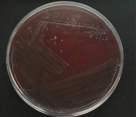 Listeria Monocytogenes On Oxford Agar
