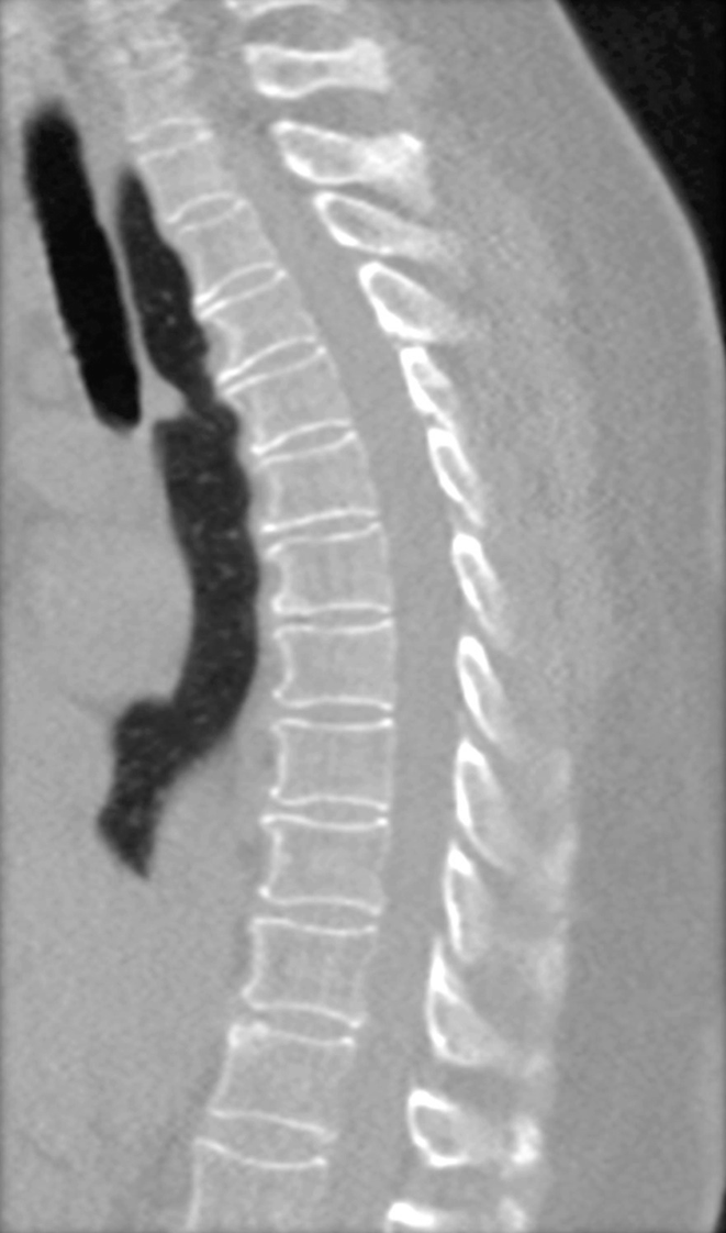 Doctors Stunned Patients Osseous Structures Completely Intact - 2rjlsbu