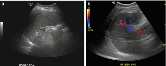 Spleen Anatomy, Function and Development | SpringerLink