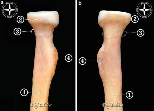 Elbow Anatomy | SpringerLink