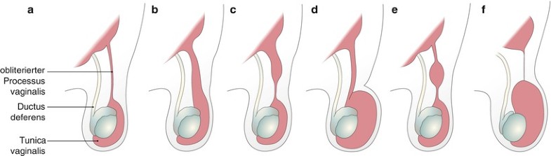 Rechter Hoden Doppelt So Groß Wie Linker Operative Anatomie: Hoden | SpringerLink