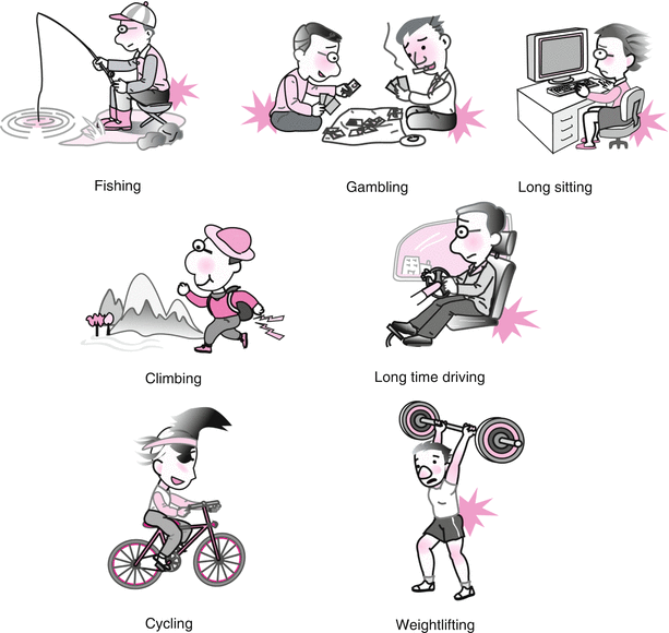 The Pathophysiology of Hemorrhoids SpringerLink