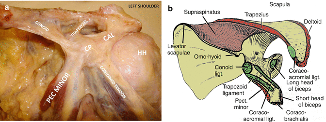 Coracoid Process | SpringerLink