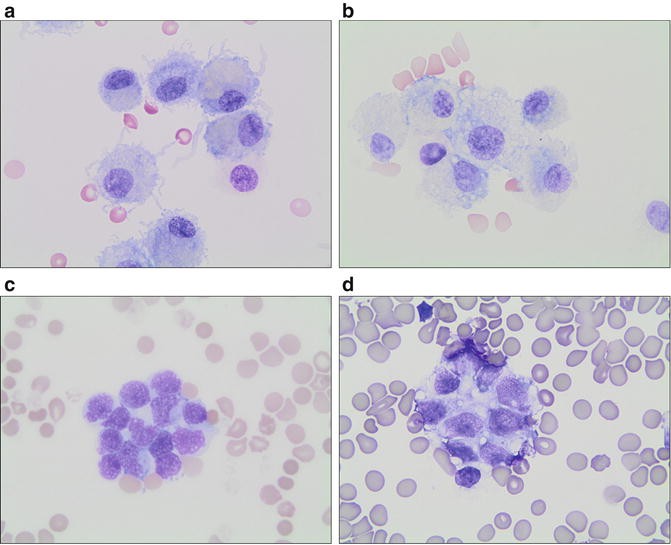 Artifacts, Contaminants, and Mimics in Cytology | SpringerLink