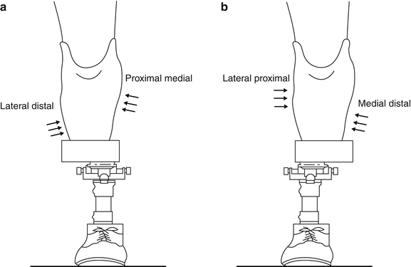 Definition Of Prosthesis Synonym  : Definition And Synonyms Of Prosthesis From The Online English Dictionary From Macmillan Education.