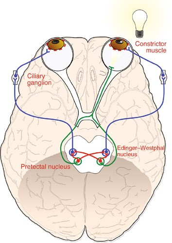 edinger westphal nucleus blown pupil