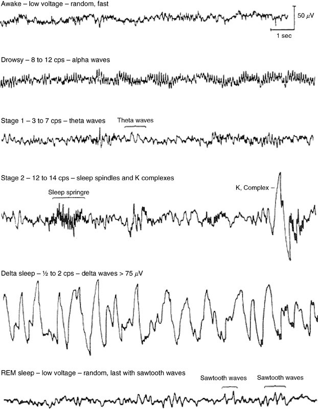 stages of sleep eeg stages of sleep eeg