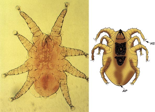 Sternostoma Tracheaculum Springerlink