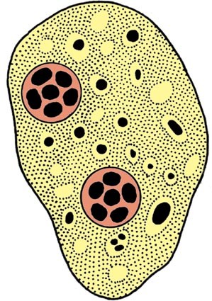 Dientamoeba Fragilis Springerlink