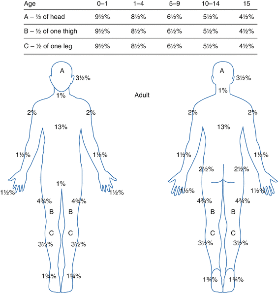 Rule Of Nines Chart Child