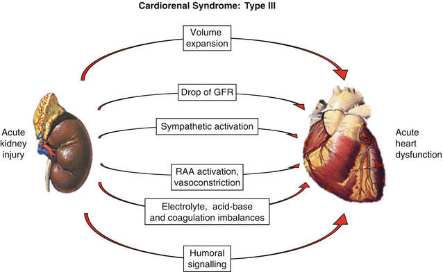 Cardiorenal Syndrome | SpringerLink