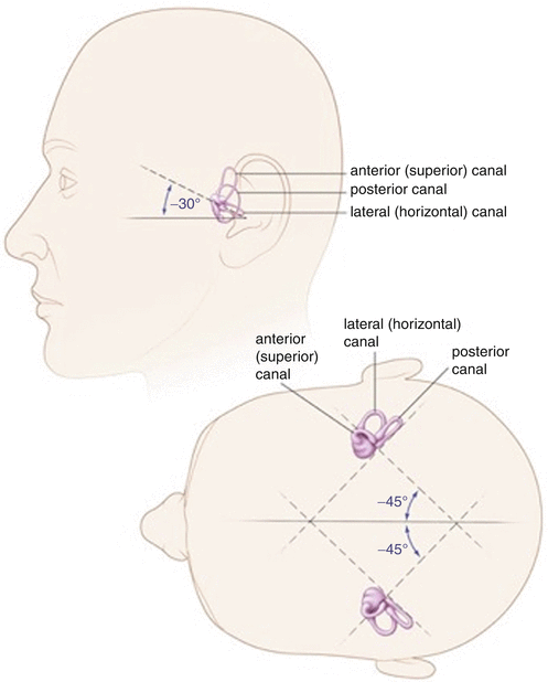 home remedies for benign paroxysmal positional vertigo