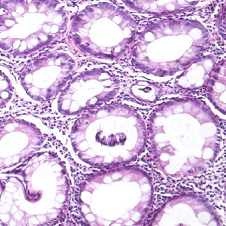 Quality in Pathology thumbnail picture