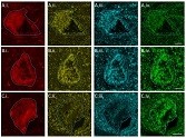 LB dementia is associated with changes to the mitochondrial respiratory chain