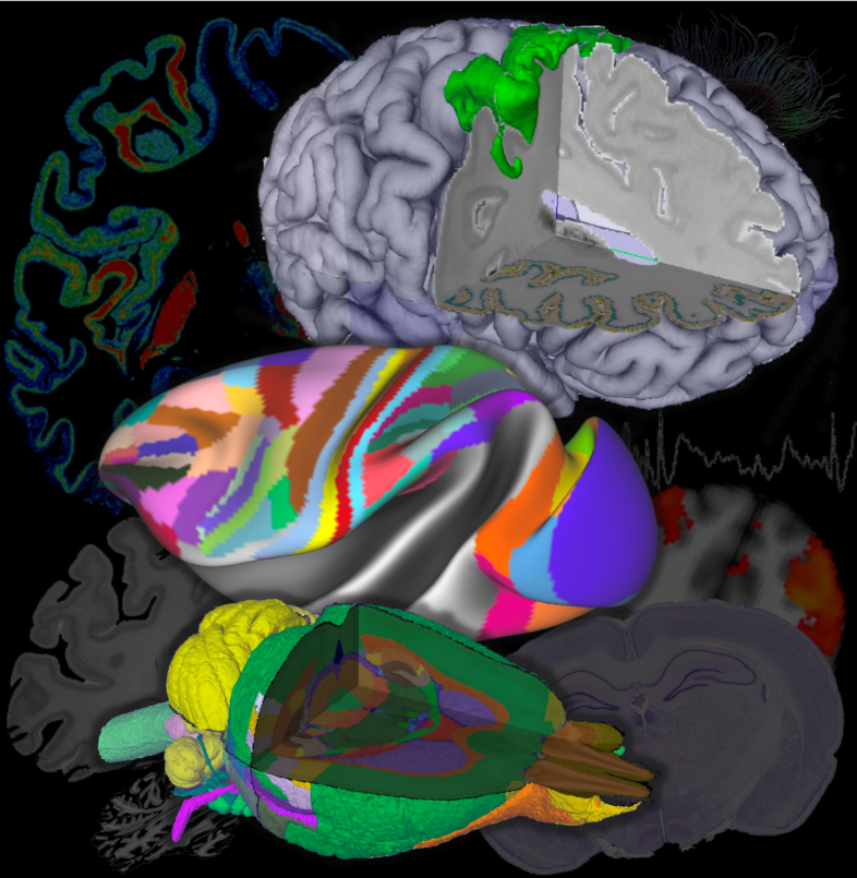 Brain Atlases illustration