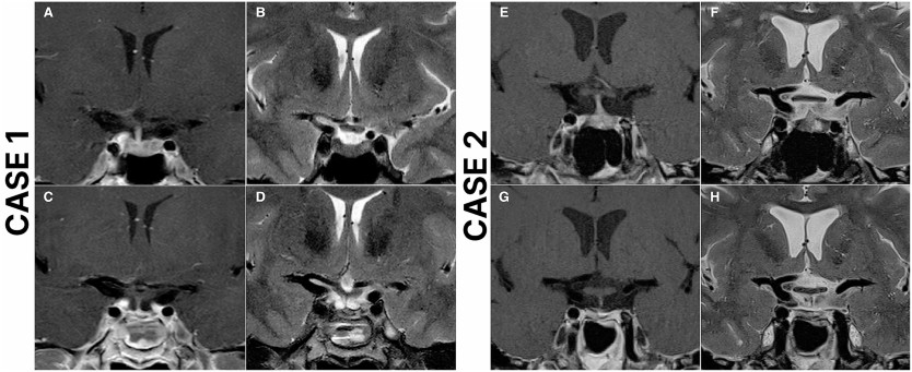 https://static-content.springer.com/image/art%3A10.1007%2Fs11102-024-01396-x/MediaObjects/11102_2024_1396_Fig2_HTML.png