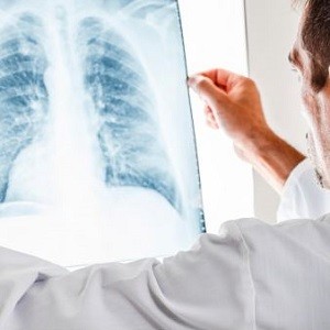 Does COPD begin in childhood?