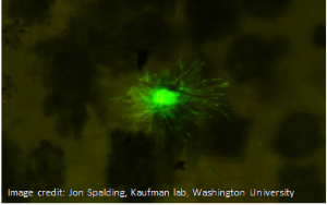 Live fluorescent image of skin from a zebrafish with an initiating melanoma cell expressing EGFP driven by a neural-crest stem cell promoter (green spindly cell, seen among other melanocytes, which are black due to the presence of melanin).