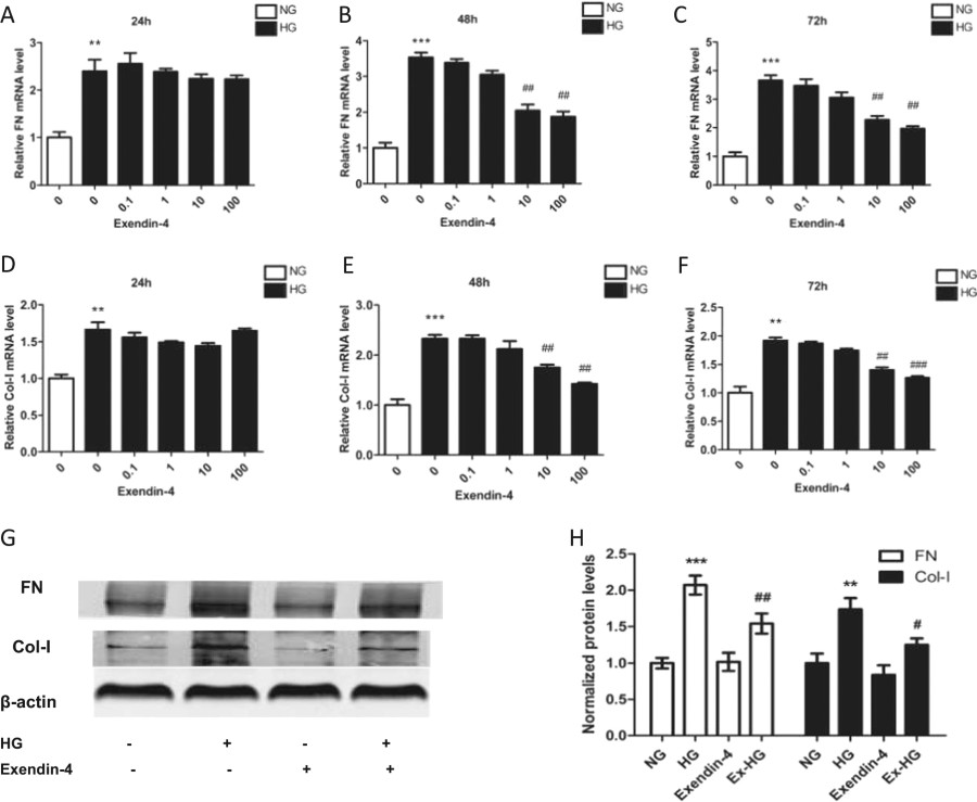 Fig 1 Effect Of Exendin 4 On Fibrosis In Hg Induced Hk 2 Cells