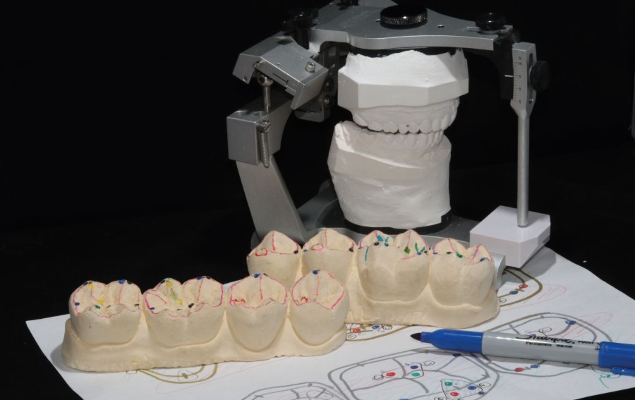 Course for comprehensive occlusion, clinical records and bite splints