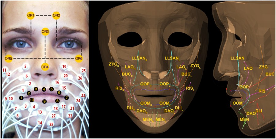 SEMG-assisted inverse modelling of 3D lip movement: A feasibility study towards person-specific modelling