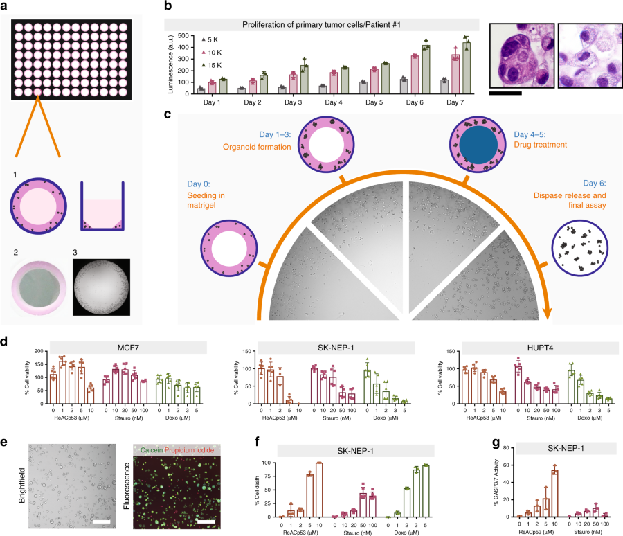 A simple high-throughput approach identifies actionable drug sensitivities in patient-derived tumor organoids