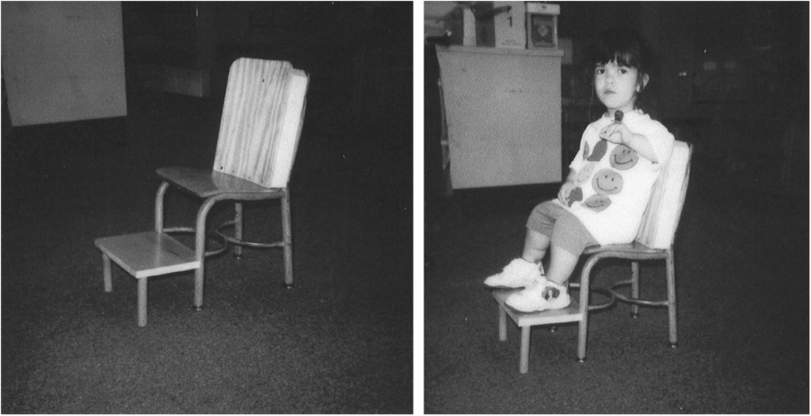 Achondroplasia A Comprehensive Clinical Review Orphanet
