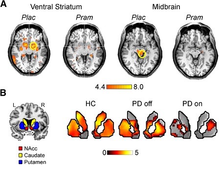 NRAP - NeurobiologicalAndClinical