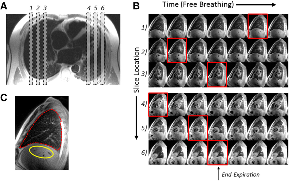 Featured article: QuantificationOfLung