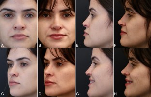extended data figure 5