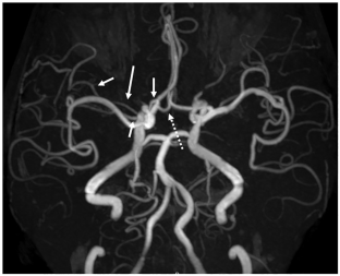 literature review on magnetic resonance imaging