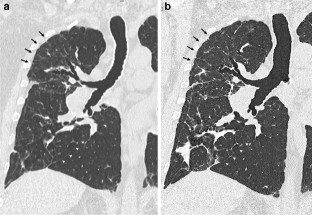 extended data figure 2