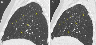 extended data figure 3
