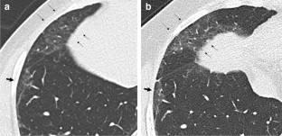 extended data figure 6